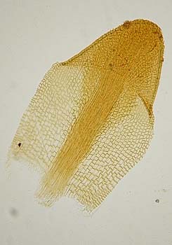 Aloinella galeata andina Mathews 2409