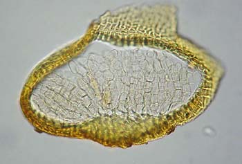 Aloinella galeata v galeata, Schi. & Bias. 1441  