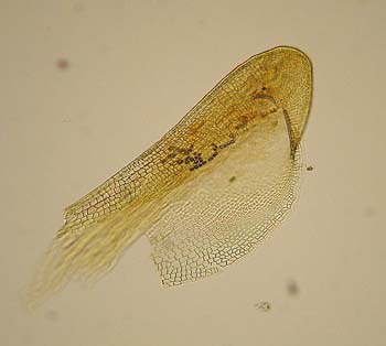 Aloinella galeata v galeata, Schi. & Bias. 1441 