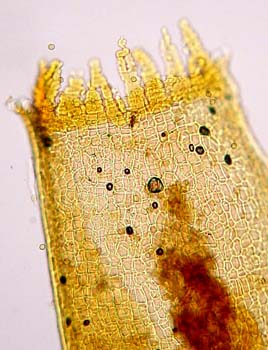 G. mexicana Sharp 4753 peristome