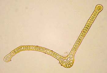 G. pulla AC 2452 leaf c.s