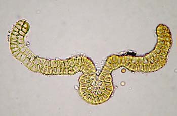 G. reflexidens Mahu 9686 leaf c.s