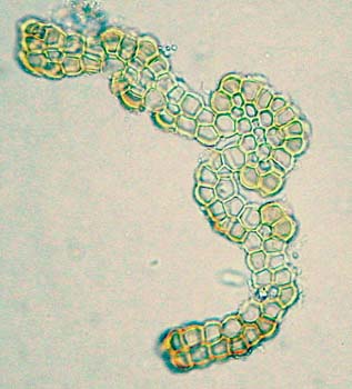 G. tenerrima Hedderson 1235
