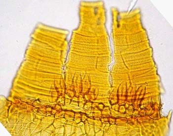 Grimmia involucrata , peristome AC 3912