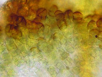 Grimmia trichophylla CD 2202 gemmae